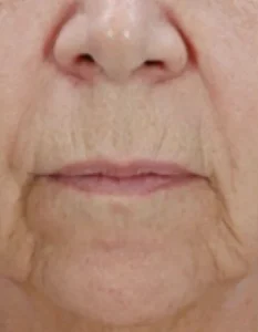 BEFORE2-400x516.jpg